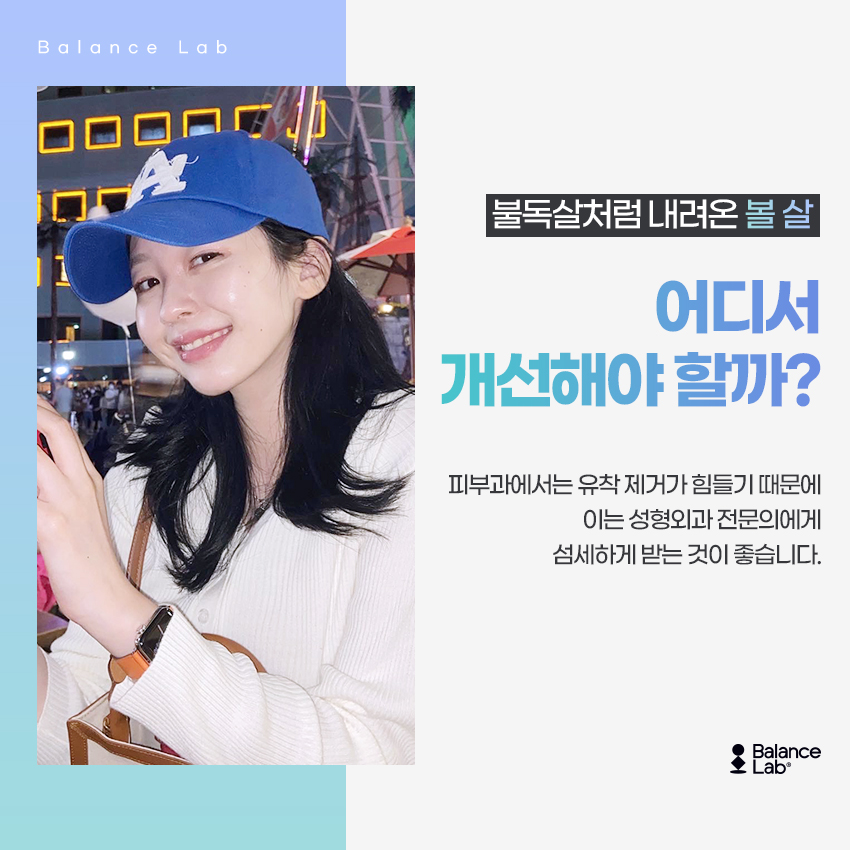 마리오네트 리프팅?! 주름개선에 도움 되는 성형외과 솔루션 관련 이미지 4