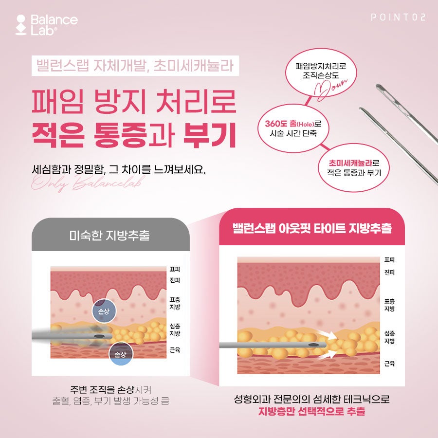 Sinsa Station Fat Extraction Injections, Making a Straight Waist Look Slimmer image 6