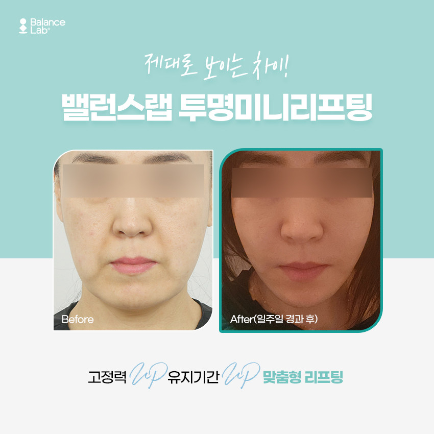 What Matters More for Sagging Cheeks: Mini Facial Lifting Reviews or Price? image 3