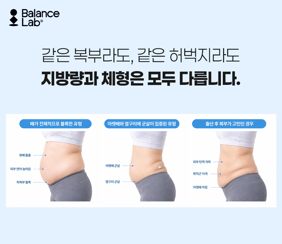 뱃살빼는법, 운동만으로 안 빠진다면? 복부지방흡입과 지방추출주사 관련 이미지 3