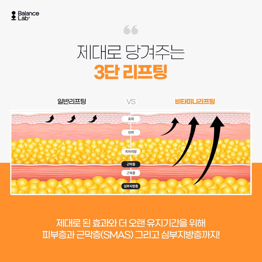 If You’re Looking for a Mini Lift With No Side Effects in a Review, Balance Lab Plastic Surgery at Sinsa Station image 5
