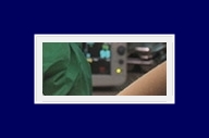 다한증없애는법 일상생활 불편하게 하는 다한증, 원인에 알맞는 치료 관련 이미지 23
