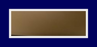 SIT Surgery That Can Simultaneously Improve Underarm Odor, Bromhidrosis, and Hyperhidrosis image 14