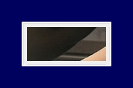 다한증없애는법 일상생활 불편하게 하는 다한증, 원인에 알맞는 치료 관련 이미지 29