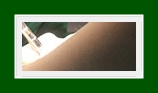 What Is SIT Surgery for Armpit Odor Removal, from the Cause of Armpit Odor to Complete Removal? image 24