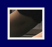 액취증제거 근본적으로 할 수 있는 특허받은 SIT치료 기술 관련 이미지 34
