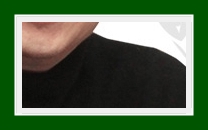 Treatment Methods for Hyperhidrosis: Even in Winter, Hyperhidrosis Can Be Hard to Live With — What Is the Fundamental Treatment, SIT Surgery? image 26