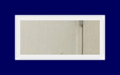 What Are the Treatment Options for Hyperhidrosis? Treatment with SIT Surgery image 12