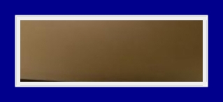Armpit odor symptoms: troublesome bromhidrosis, resolved with SIT surgery image 15