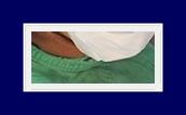 How to Treat Underarm Odor: End Your Body Odor Worries with SIT Surgery! image 12