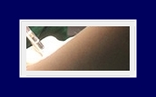 How to Treat Underarm Odor: End Your Body Odor Worries with SIT Surgery! image 26