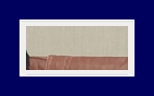 What Are the Treatment Options for Hyperhidrosis? Treatment with SIT Surgery image 18
