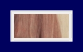 What Are the Treatment Options for Hyperhidrosis? Treatment with SIT Surgery image 24