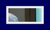 If Underarm Sweat Odor Treatment for Hyperhidrosis or Bromhidrosis Is Severe, Start Treatment Now image 14
