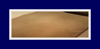 암내치료방법 원인부터 파악하자! 근본적인 치료방법 SIT수술 관련 이미지 23