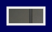 If Underarm Sweat Odor Treatment for Hyperhidrosis or Bromhidrosis Is Severe, Start Treatment Now image 12