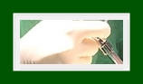 What Is SIT Surgery for Armpit Odor Removal, from the Cause of Armpit Odor to Complete Removal? image 18