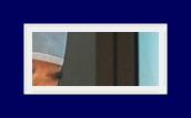 If Underarm Sweat Odor Treatment for Hyperhidrosis or Bromhidrosis Is Severe, Start Treatment Now image 24