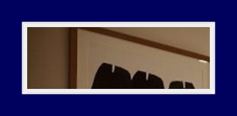 겨드랑이 땀냄새 고통스러운 액취증 고민, SIT수술로 탈출하기 관련 이미지 17
