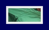 How to Treat Underarm Odor: End Your Body Odor Worries with SIT Surgery! image 11