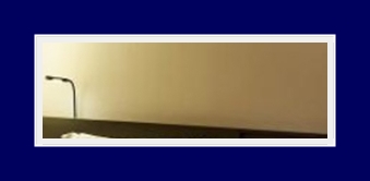 SIT Surgery That Can Simultaneously Improve Underarm Odor, Bromhidrosis, and Hyperhidrosis image 13