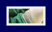 How to Treat Underarm Odor: End Your Body Odor Worries with SIT Surgery! image 24