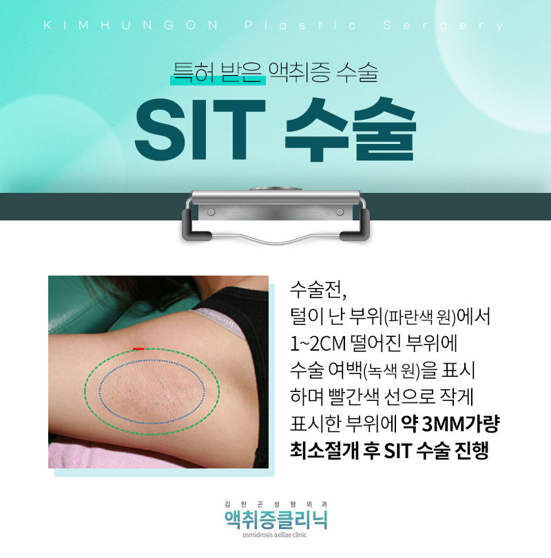 겨드랑이액취증 겨울철 한파에도 사라지지 않는 이유와 SIT수술 방법 관련 이미지 6