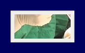 How to Treat Underarm Odor: End Your Body Odor Worries with SIT Surgery! image 25