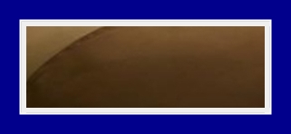 Can Severe Underarm Odor Be Treated at the Root? image 27