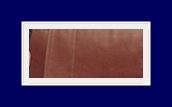 What Are the Treatment Options for Hyperhidrosis? Treatment with SIT Surgery image 23