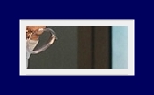 If Underarm Sweat Odor Treatment for Hyperhidrosis or Bromhidrosis Is Severe, Start Treatment Now image 29