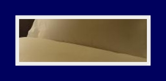 SIT Surgery That Can Simultaneously Improve Underarm Odor, Bromhidrosis, and Hyperhidrosis image 20