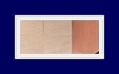 Why Underarm Body Odor Can Be Severe Even in Cold Weather, and Its Symptoms and Treatment Methods image 14