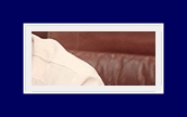 What Are the Treatment Options for Hyperhidrosis? Treatment with SIT Surgery image 28
