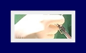 How to Treat Underarm Odor: End Your Body Odor Worries with SIT Surgery! image 20