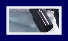 How to Remove Bromhidrosis: Removing Severe Bromhidrosis Even in Winter with SIT Surgery image 12