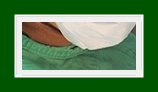 What Is SIT Surgery for Armpit Odor Removal, from the Cause of Armpit Odor to Complete Removal? image 12