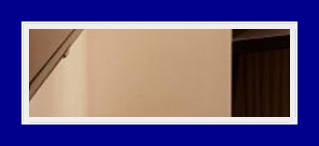 Armpit odor symptoms: troublesome bromhidrosis, resolved with SIT surgery image 21