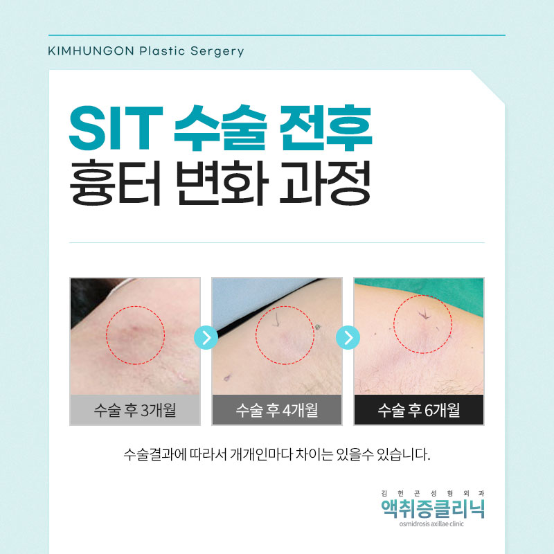 소아액취증 초등학생 아이들부터 가능한 특허받은 치료방법 관련 이미지 7