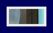 If Underarm Sweat Odor Treatment for Hyperhidrosis or Bromhidrosis Is Severe, Start Treatment Now image 19