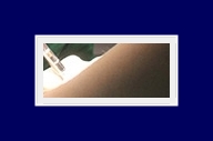 다한증없애는법 일상생활 불편하게 하는 다한증, 원인에 알맞는 치료 관련 이미지 28
