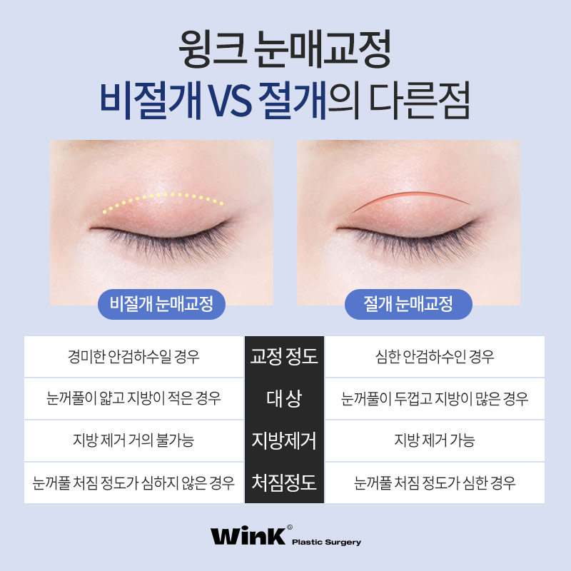 윙크성형외과 비절개 or 절개 눈매교정! 나에게 맞는 눈매교정은? 관련 이미지 3