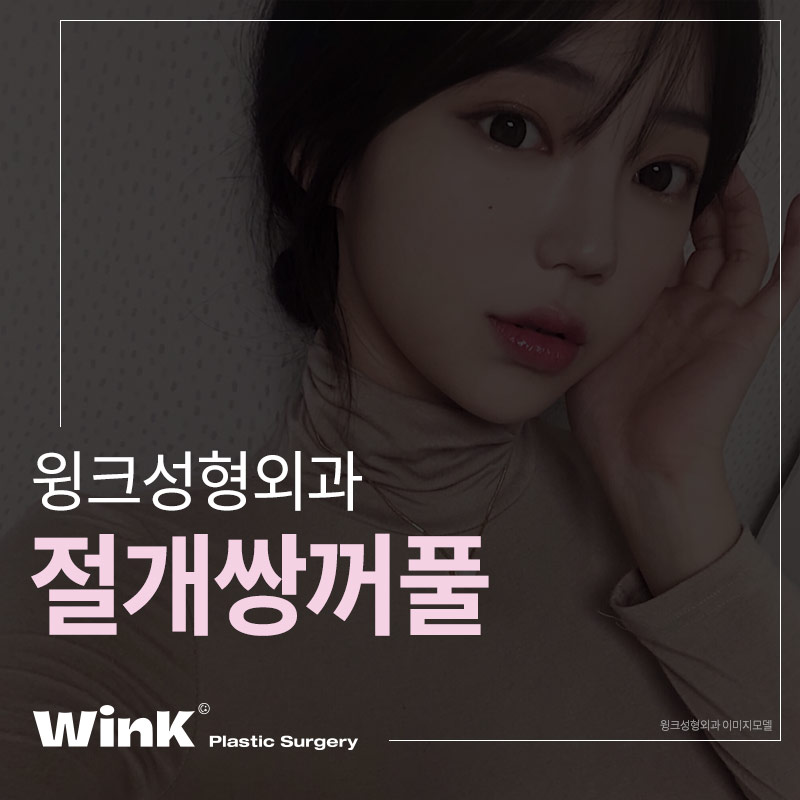 윙크성형외과 절개쌍꺼풀 풀리지 않고 또렷하게 관련 이미지 1