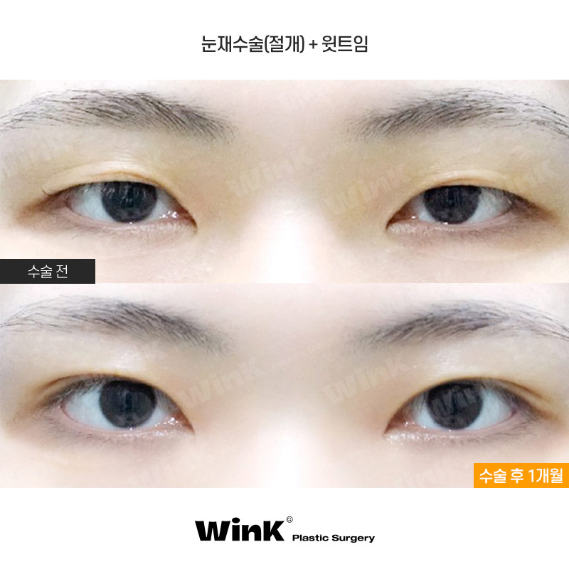 윙크 윗트임으로 날카로운 눈매를 부드럽게! 관련 이미지 1