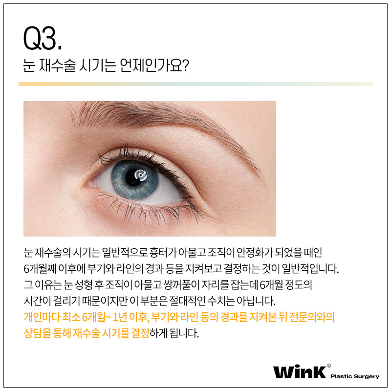 윙크성형외과에서 알려드리는 눈성형의 모든것! 관련 이미지 6