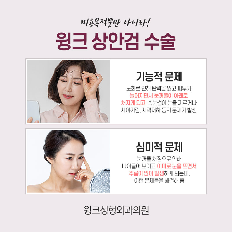중년눈성형 상안검수술을 알아보자. 관련 이미지 4