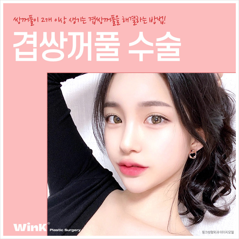 겹주름쌍꺼풀 겹쌍 쌍꺼풀여러겹 겹쌍꺼풀수술은 윙크성형외과! 관련 이미지 1