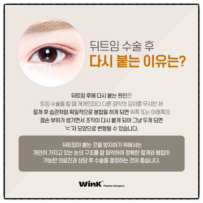 뒤트임부작용 뒤밑트임수술후기 트임잘하는곳 윙크성형외과 눈꼬리내리는수술 관련 이미지 2