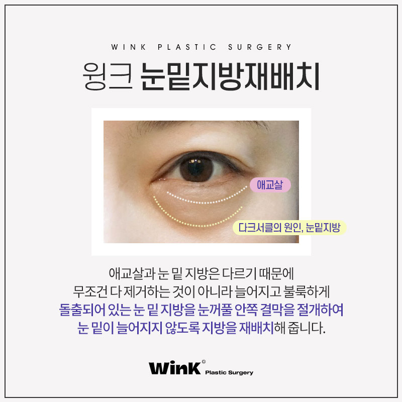 칙칙한 눈 밑, 생기 가득하게 윙크성형외과 눈밑지방재배치 관련 이미지 3