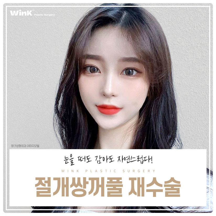 쌍꺼풀절개재수술 신사쌍꺼풀수술 쌍꺼풀수술잘하는곳? 윙크성형외과 관련 이미지 1
